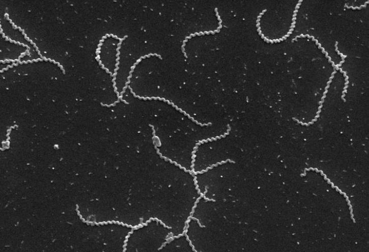 鉤端螺旋體病俗稱「鼠尿病」。(網上圖片)