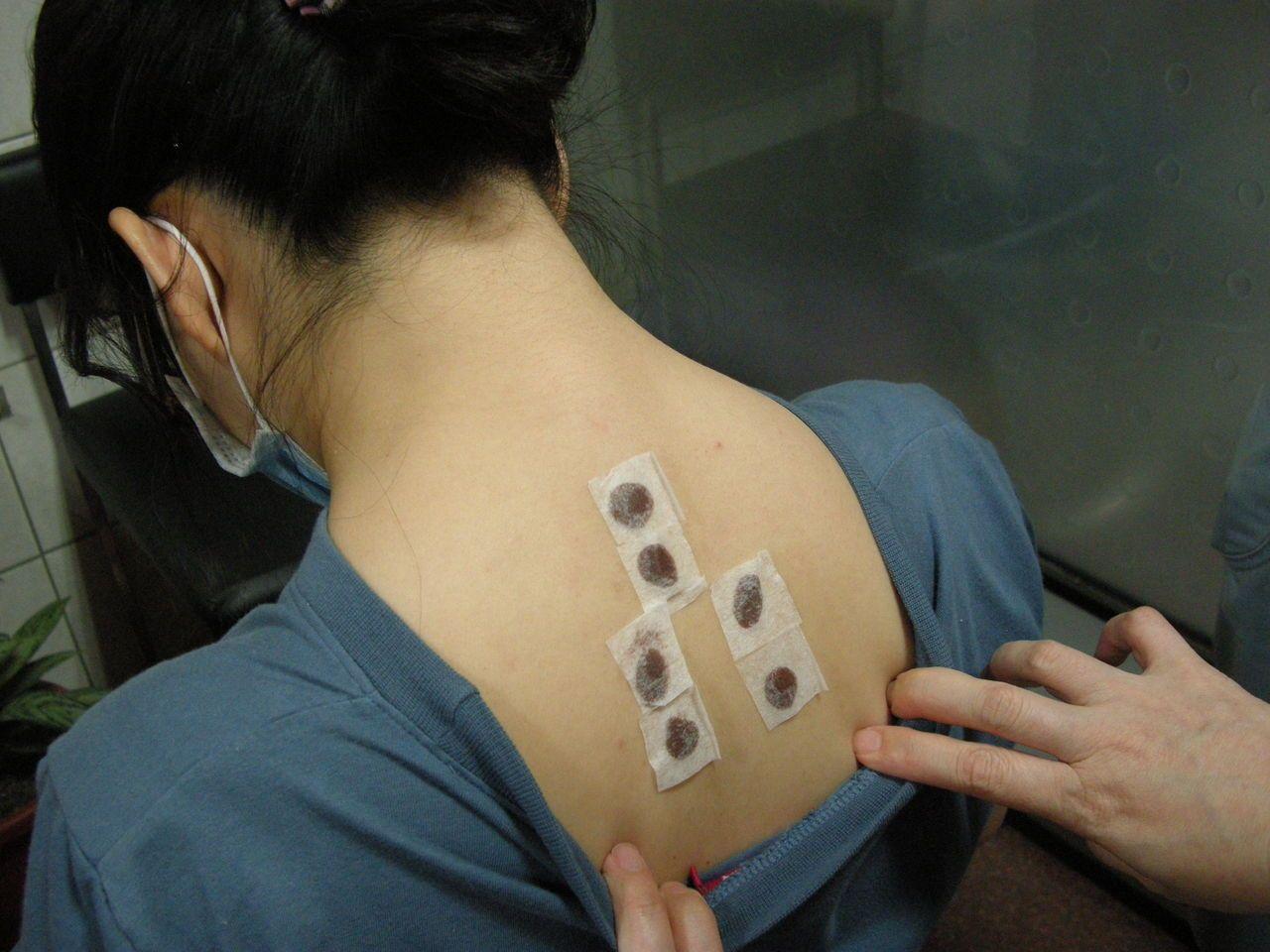 高血脂患者可以在每年約7至8月使用三伏貼輔助治療,改善相關症狀。