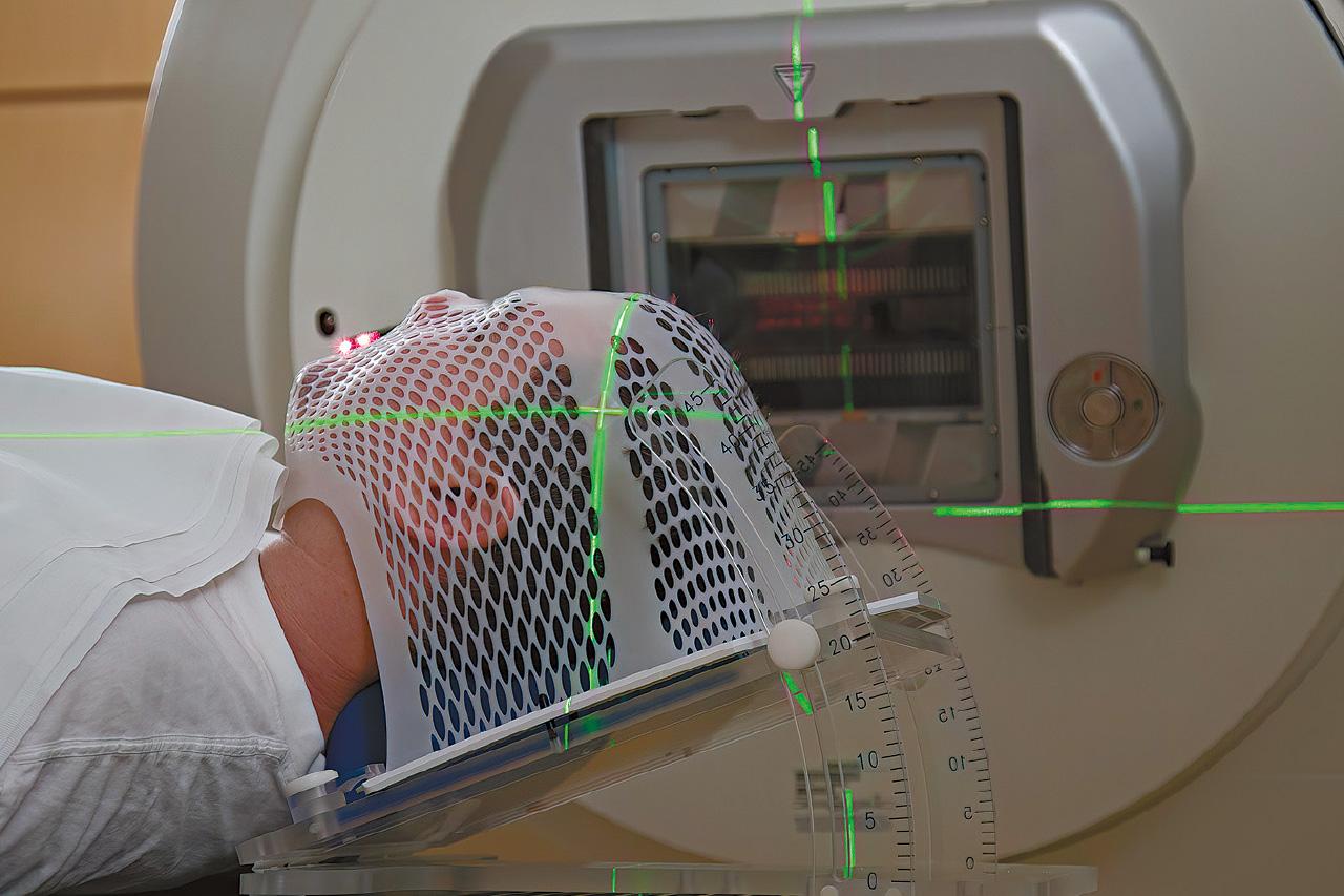 質子治療 Proton Therapy