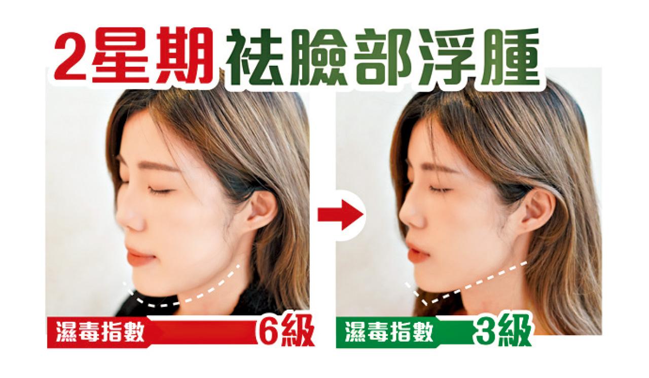 健之堂祛濕茯苓艾草貼