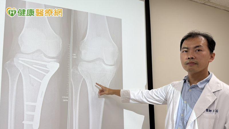 手術隔天,患者即能使用助行器下床如廁;術後也安排10次高壓氧治療,幫助傷口快速癒合、順利展開復康。