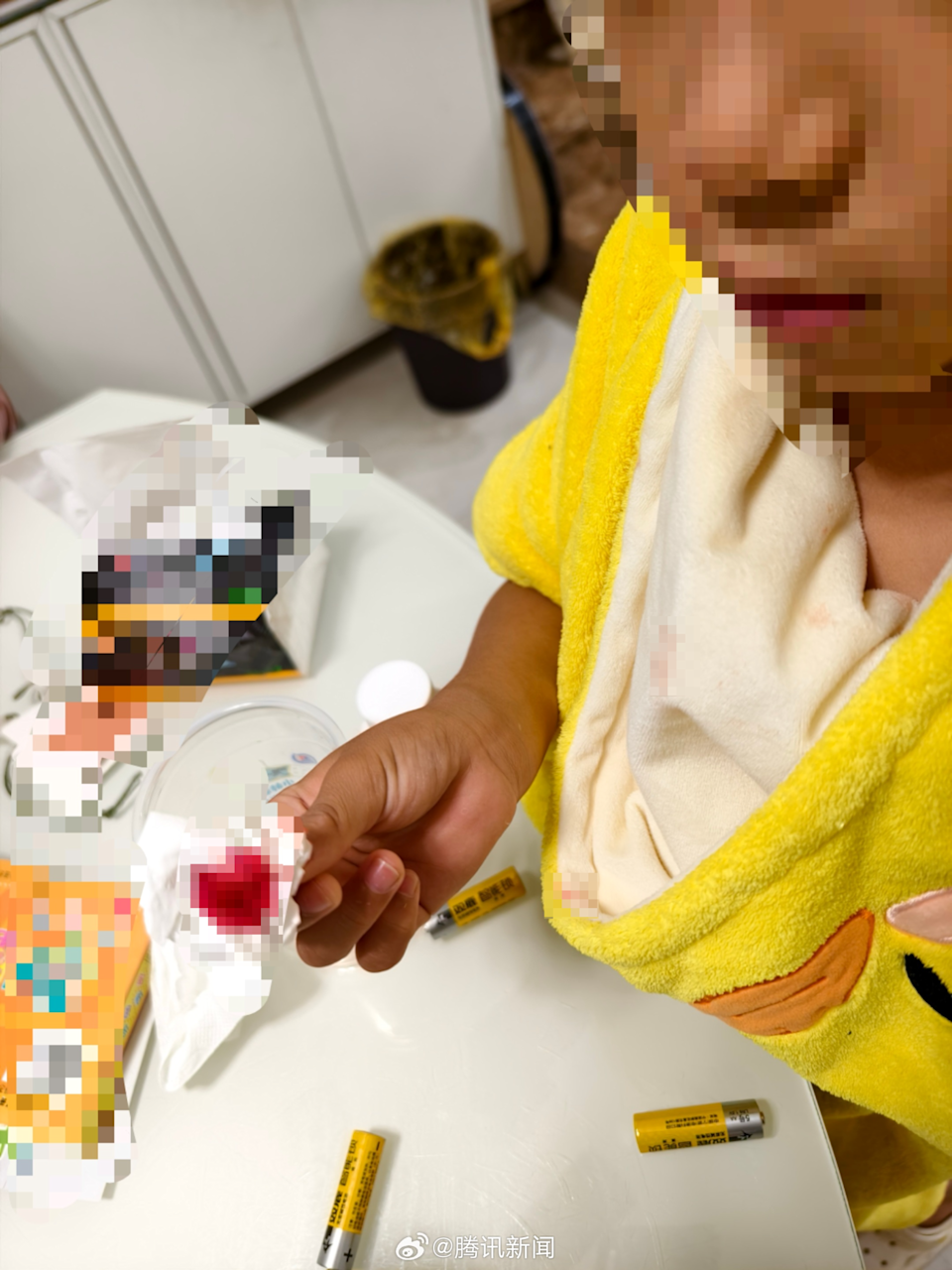 家長稱自己的孩子也有流鼻血症狀。(圖/翻攝微博@騰訊新聞)