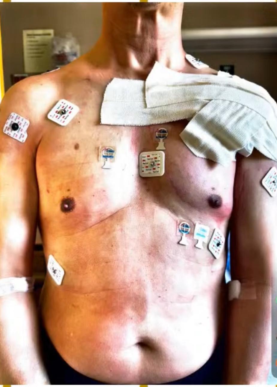 鄭敬基公開手術後照片。