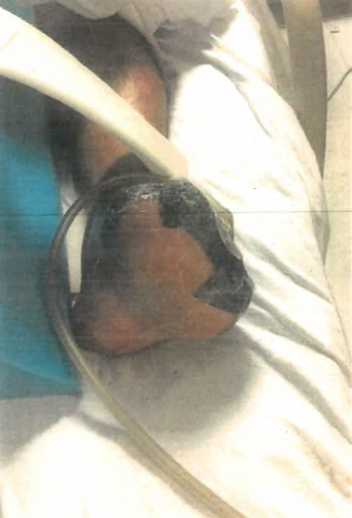 外賣員因地面破損而墜軌重傷。(網上圖片)