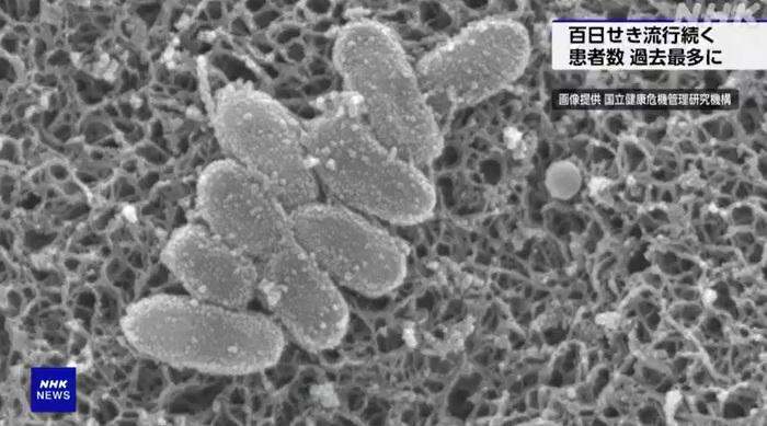 電子顯微鏡下的百日咳病菌。(互聯網)