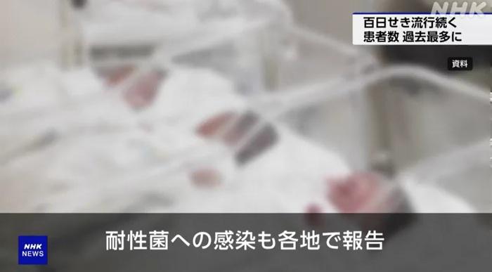 NHK報道,日本的百日咳病菌出現抗藥性。(互聯網)