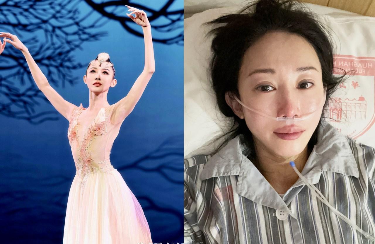 著名舞蹈家朱潔靜曾患乳腺癌 接受25次放化療 瞞著家人赴春晚彩排