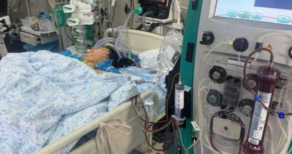 河南平頂山18歲女學生蔣晨楠,一度要依靠人工心肺機維持生命。