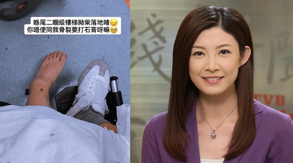 張文采跌斷腳 骨裂打石膏需坐輪椅 曾戀「負評王」羅鈞滿自嘲太蠢