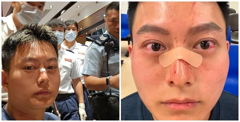 葉子健事後在社交平台Instagram上傳多則限時動態,他當時正在一間食肆與友人「打邊爐」;及後他鼻上染血並貼有膠布登上救護車稱:「頭先打邊爐嘅時候呢,劉馬車打咗我幾拳,打到我瞓低咗,而家上白車。」他在醫院亦與友人拍下合照,可見其上衣背後位置損毀。