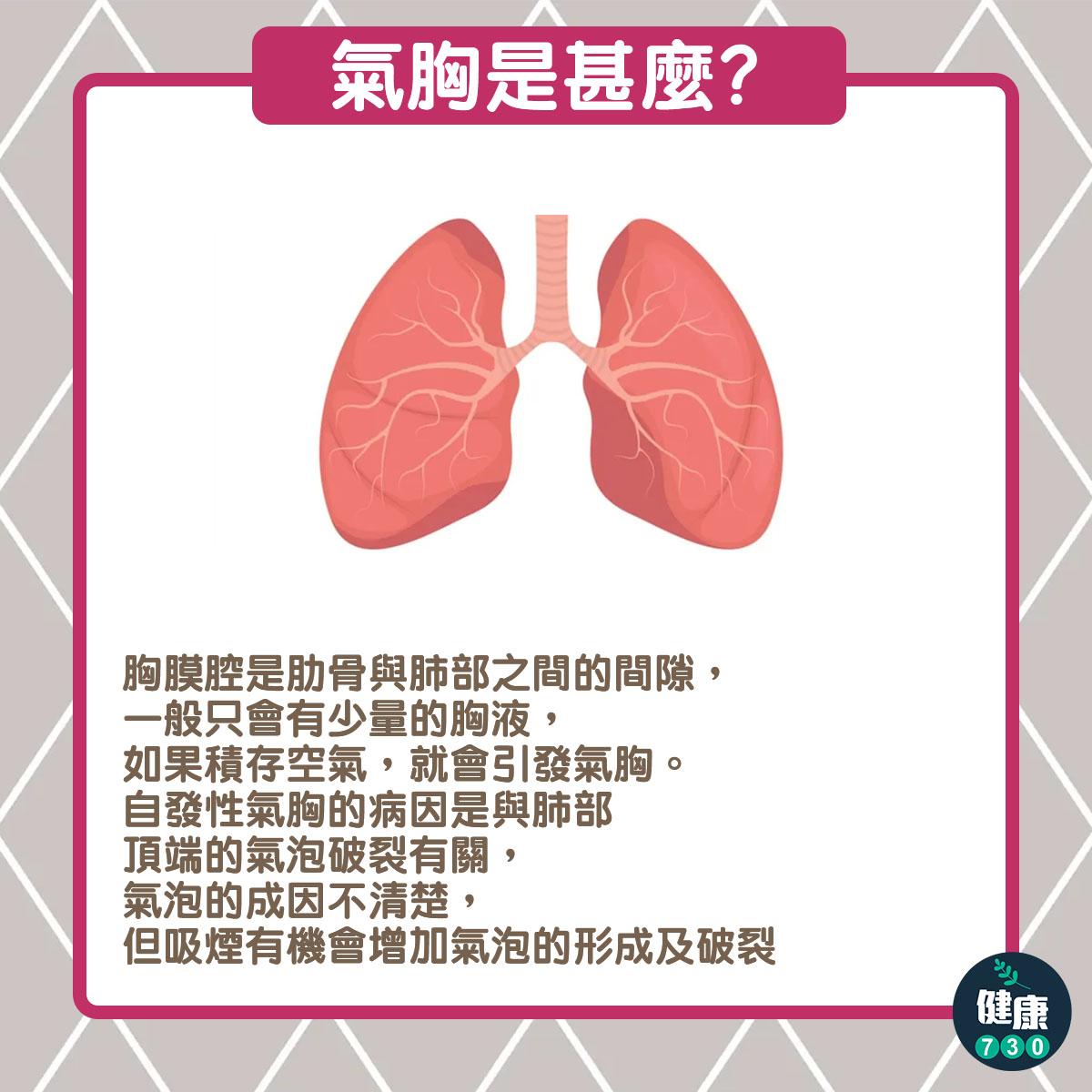 氣胸=爆肺|(am730製圖)