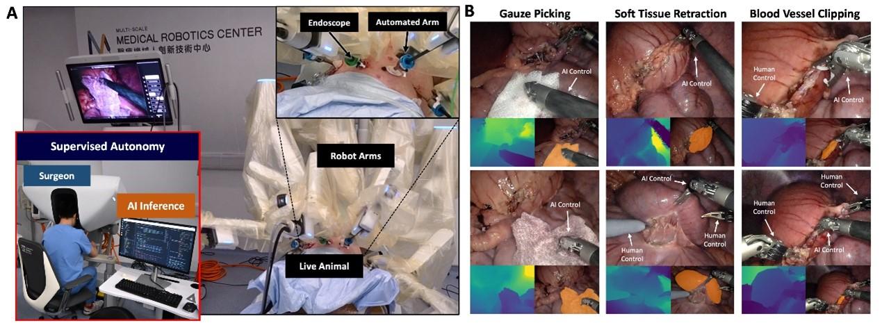 機械人的高清立體內窺鏡系統,在毋須任何額外感測器協助下,自主完成了紗布拾取、軟組織牽引,以及血管夾閉等核心任務。(互聯網)