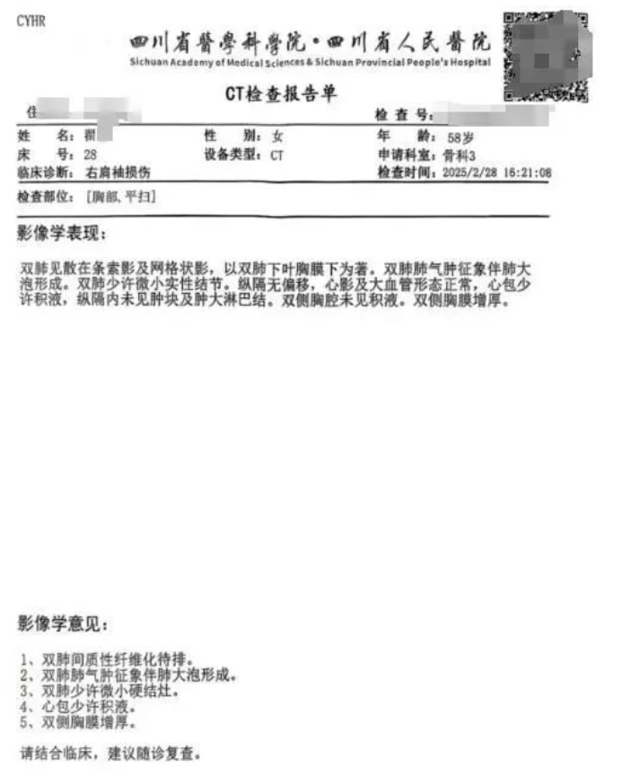四川省人民醫院涉調亂患者的電腦斷層掃描(CT)影像,使一名女子被誤診絕症,服藥3個月後才發現誤診 。(網上圖片)
