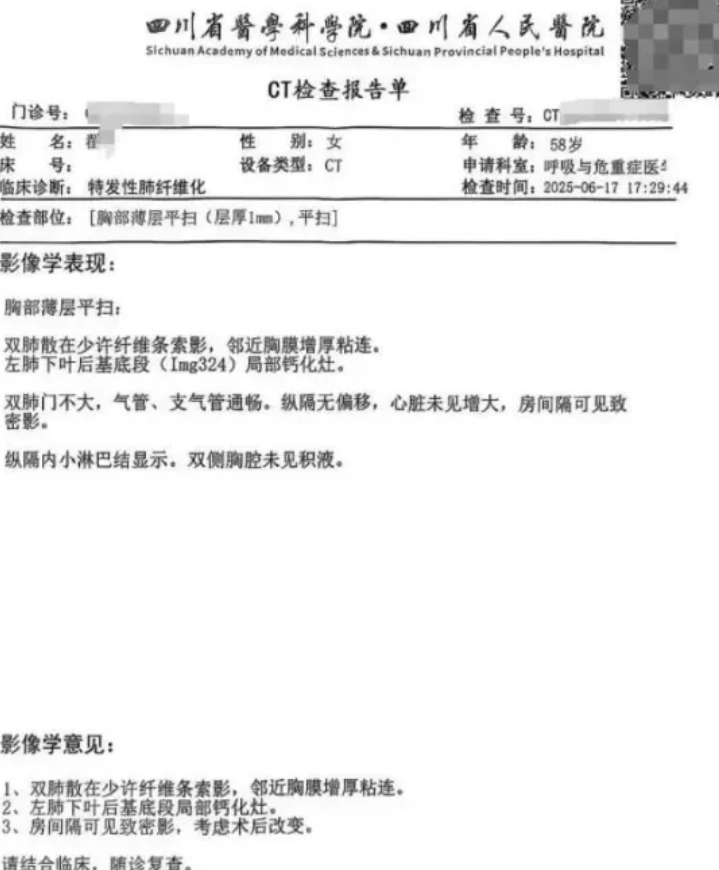 四川省人民醫院涉調亂患者的電腦斷層掃描(CT)影像,使一名女子被誤診絕症,服藥3個月後才發現誤診 。(網上圖片)