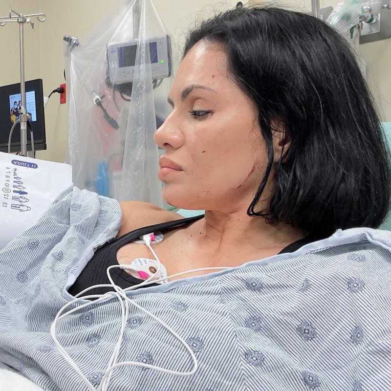 Nina上載病床照片。(IG)