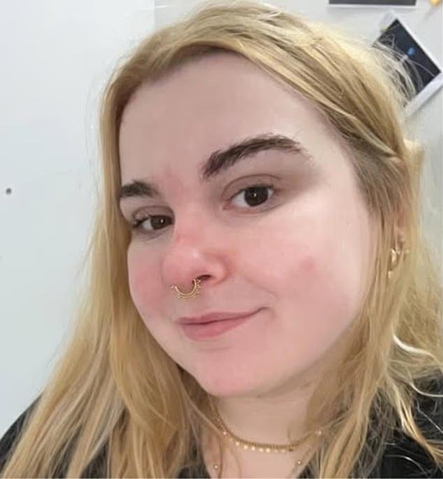 22歲女喉嚨痛入院5天死亡 膿腫阻塞呼吸道