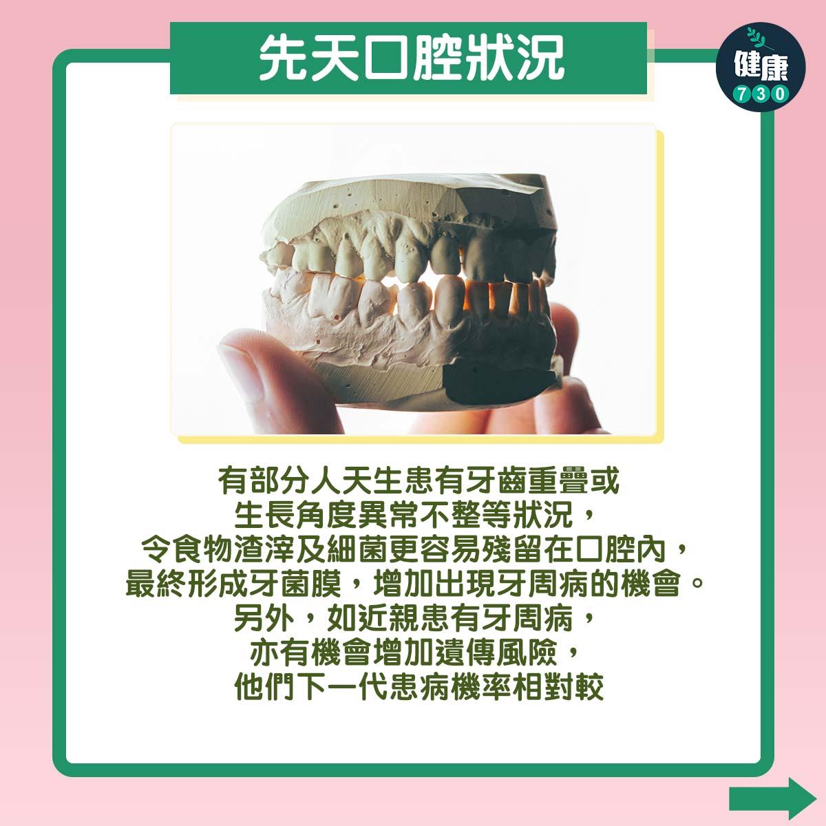 牙周病三大成因|先天口腔狀況(am730製圖)