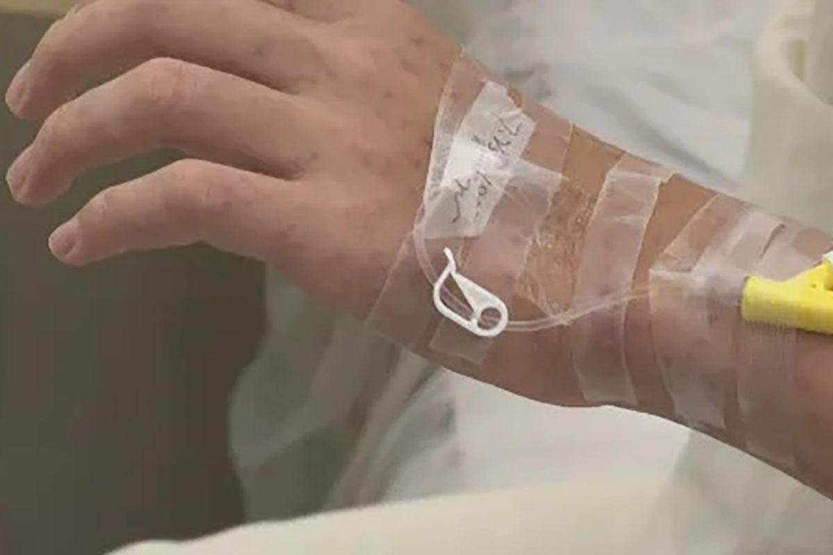 有患者稱,起初見身上突發紅疹都不以為意,其後便開始發燒。(微信公眾號「三水發布」)