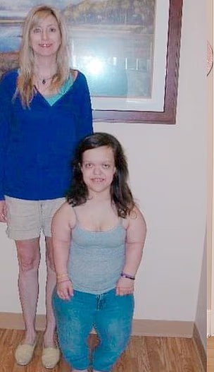 克魯斯患有侏儒症。(互聯網)