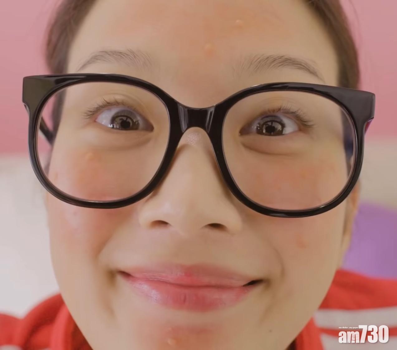 無論暗瘡有多嚴重也不要用手擠暗瘡。