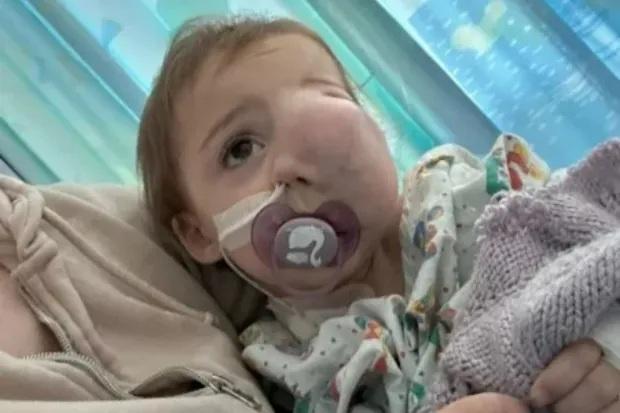 英國1歲女嬰臉現腫塊遭誤診父母傷害造成 腫瘤迅速擴大7個月後離世