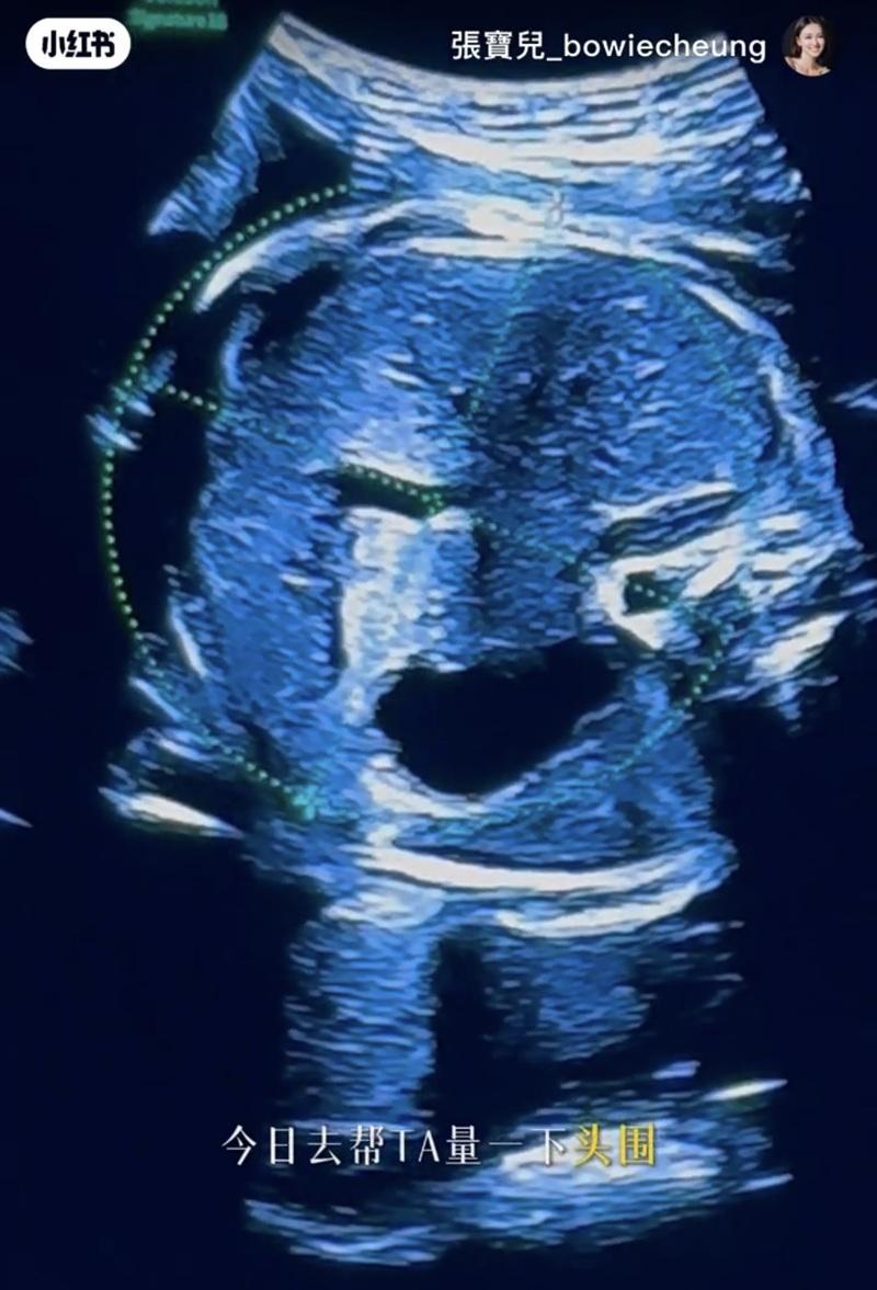 近日做產檢,BB一切健康。