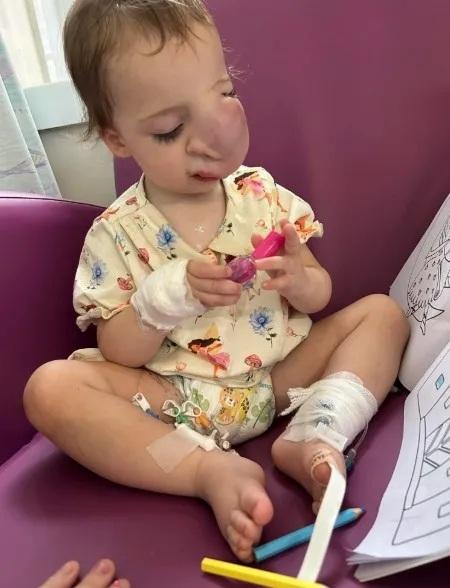 英國1歲女嬰臉現腫塊遭誤診父母傷害造成 腫瘤迅速擴大7個月後離世