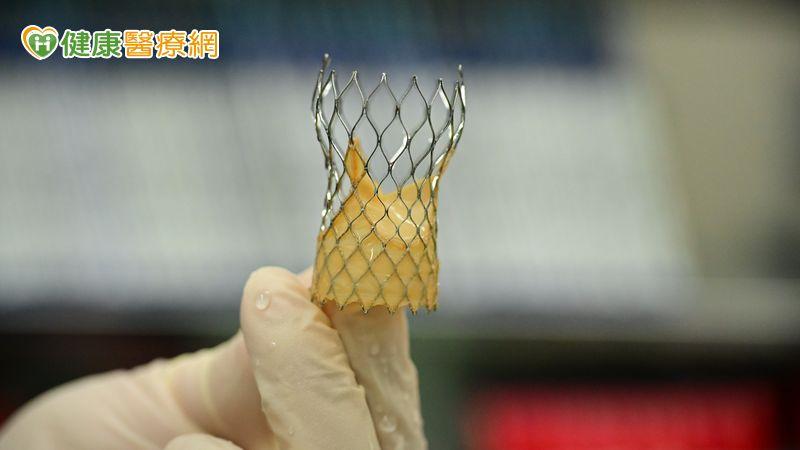 「經導管主動脈瓣膜植入術」(TAVI/TAVR)則是新型手術,僅透過導管從股動脈、胸部或頸部,就能將人工瓣膜送入心臟取代病變瓣膜,讓血液重新順暢流動。