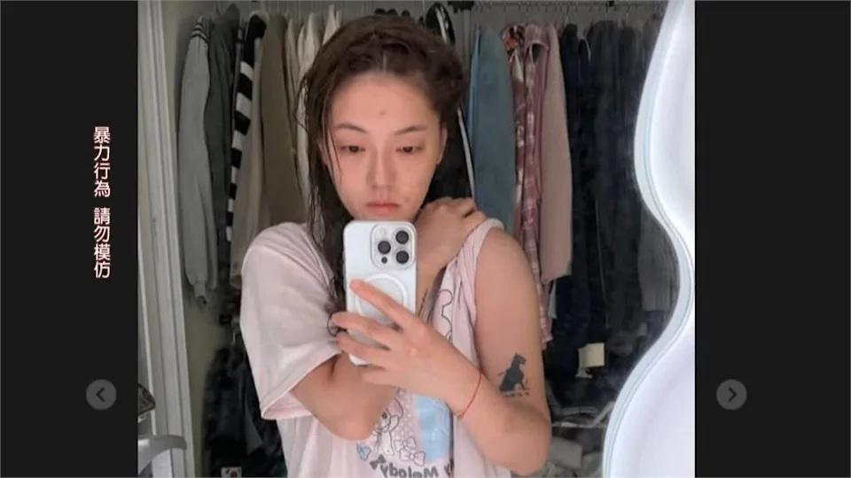 台灣女網紅南韓遭陌生男搭訕拒「過夜」 遭暴打周身瘀傷手指骨折