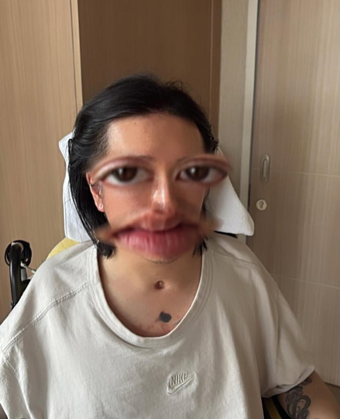 阿Mo早前公開近期樣子