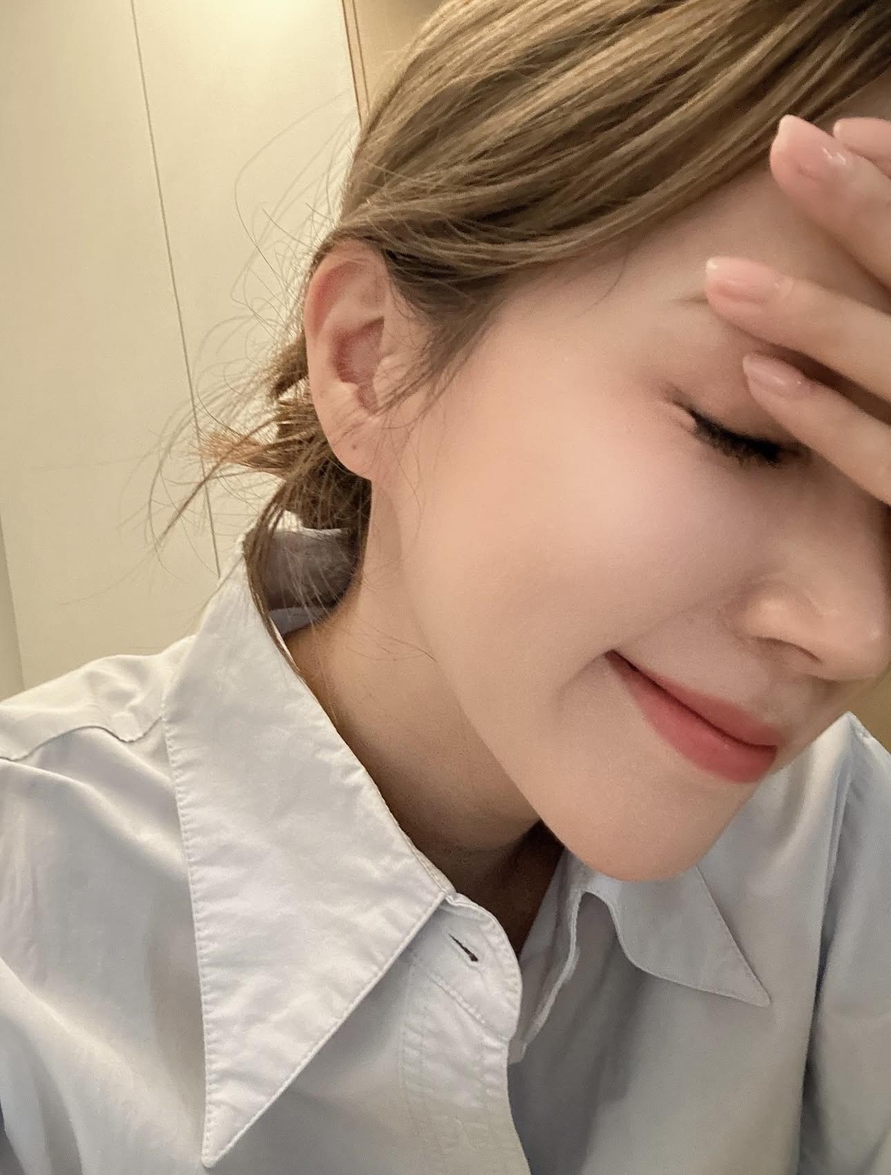 傅嘉莉換衫割走3mm眼角膜。