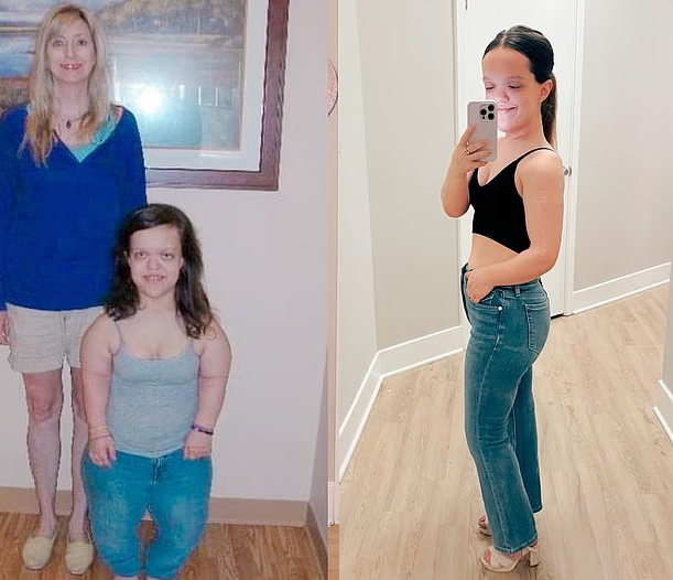 克魯斯接受肢體延長手術前(左)後(右)對比。(互聯網)