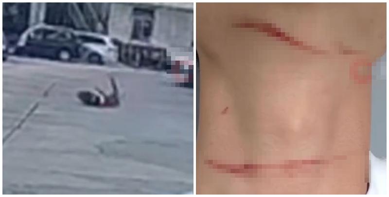 一名深圳男子日前在洪湖公園附近騎電動車時,突被風箏線勒喉割傷摔倒受傷,風箏線疑由公園飄來。(影片截圖)