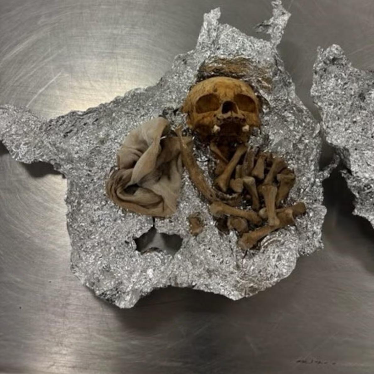 疑似人類頭骨及多根骨頭用錫紙包住,藏在行李內。(互聯網)