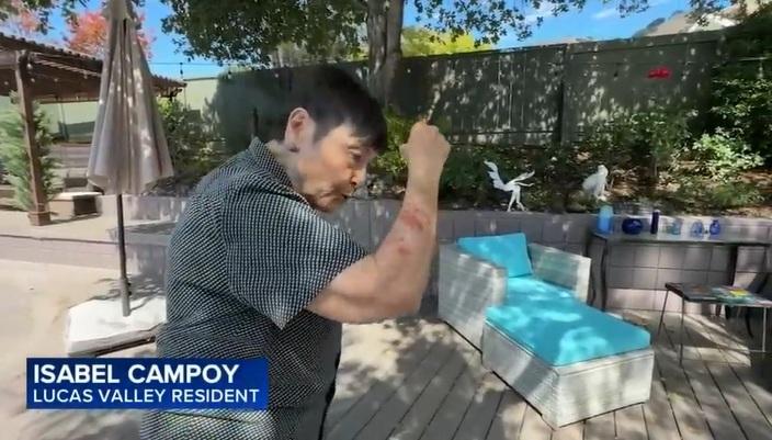 居民被松鼠突襲,抓傷手臂。(互聯網)