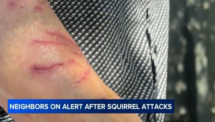 居民被松鼠突襲,抓傷手臂。(互聯網)
