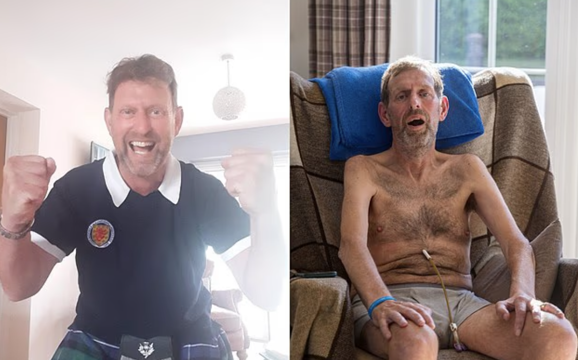 史考特公開他患病前後的照片。(互聯網)