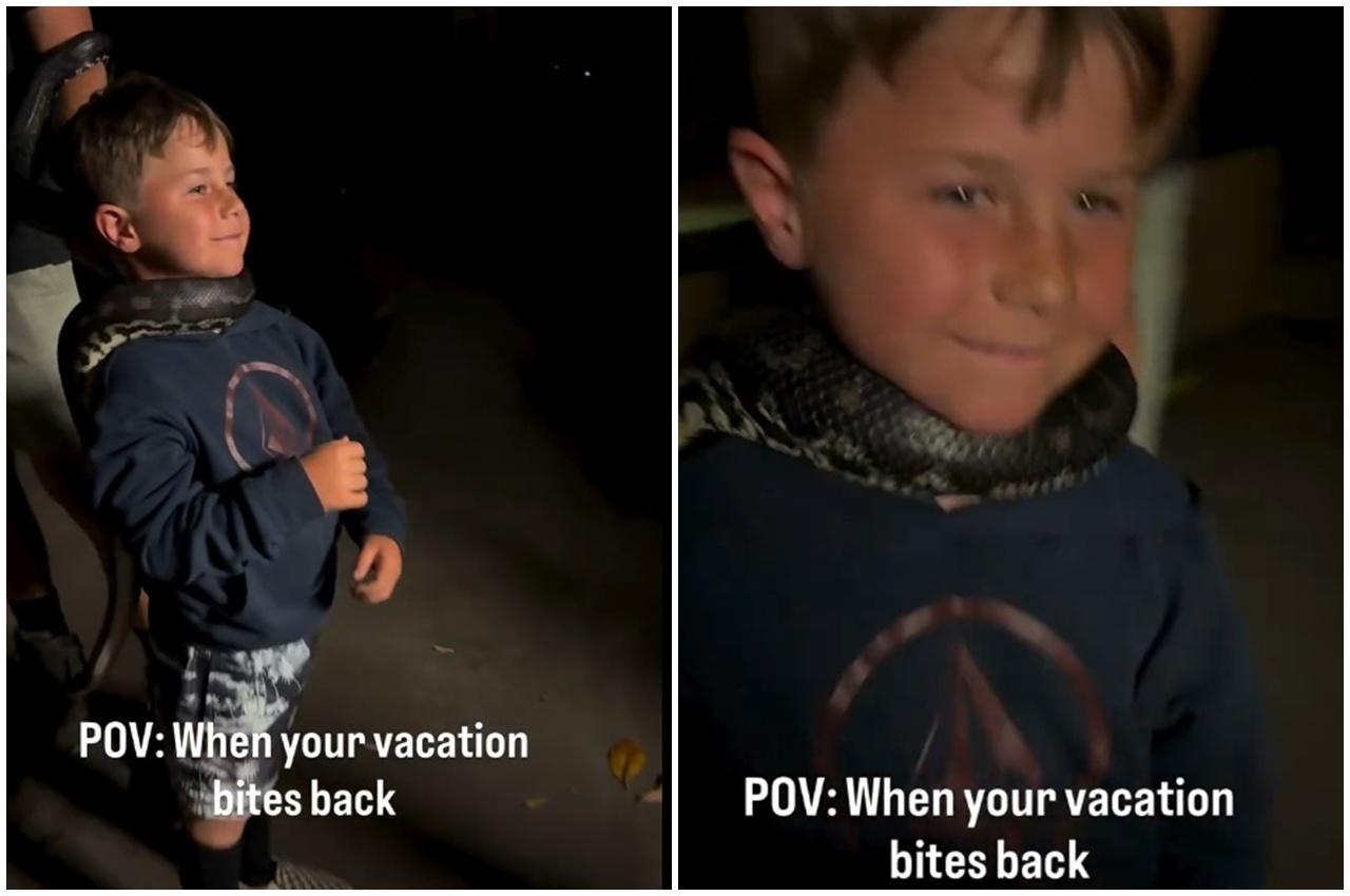 男童動物園體驗蟒蛇掛頸,慘被咬頭浴血。(IG)