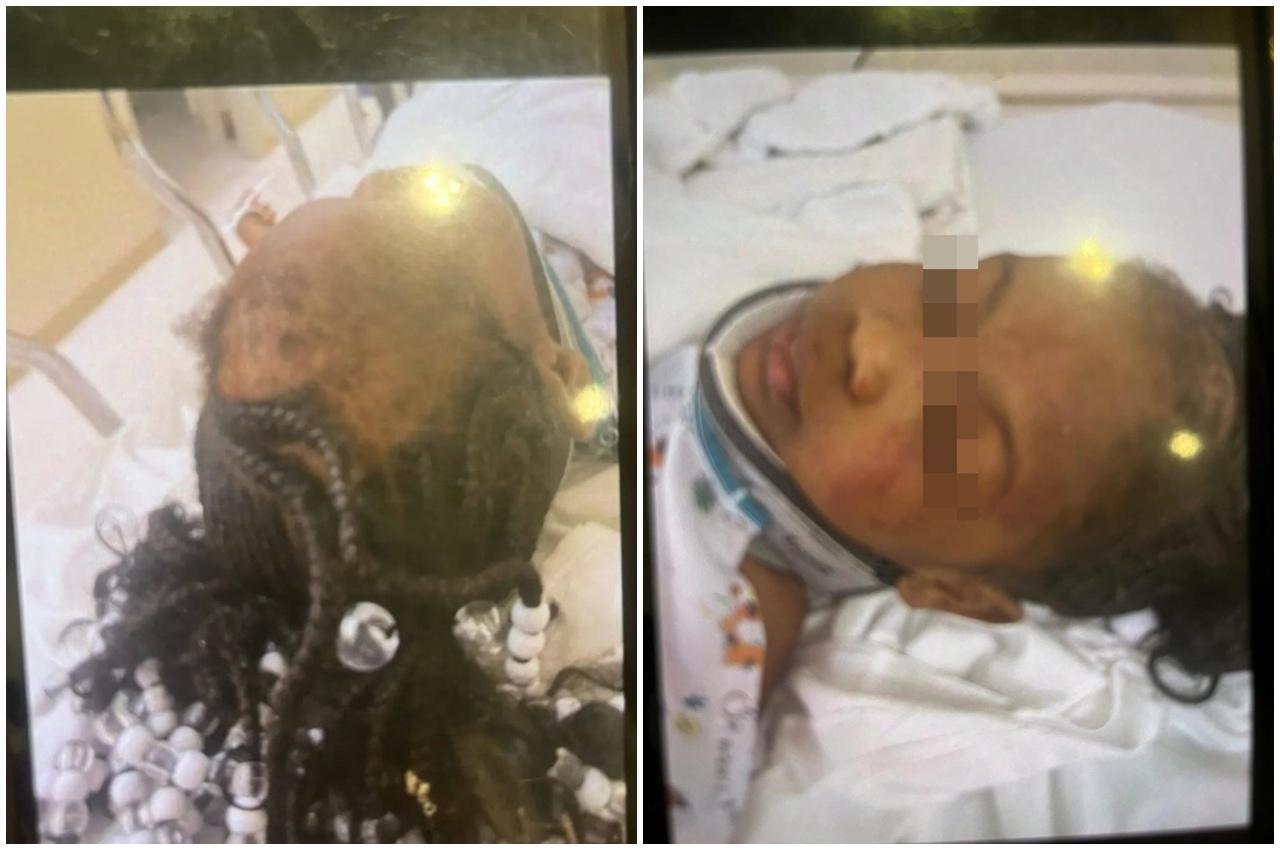 她的頭髮被扯掉,渾身都是瘀傷和鮮血。(X)