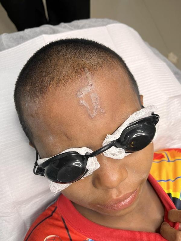 紋身師預計3次療程便可完全清除紋身。(FB)