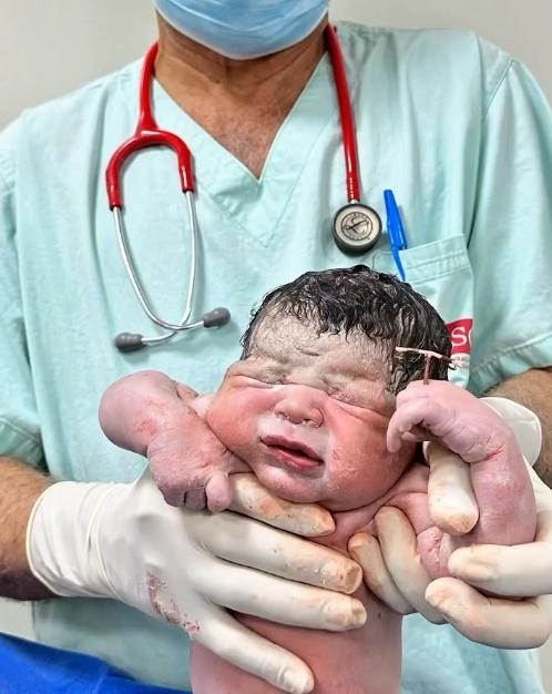 Natalia的貼文寫著:「握著我的勝利獎盃:這個未能阻止我的IUD!」(IG)