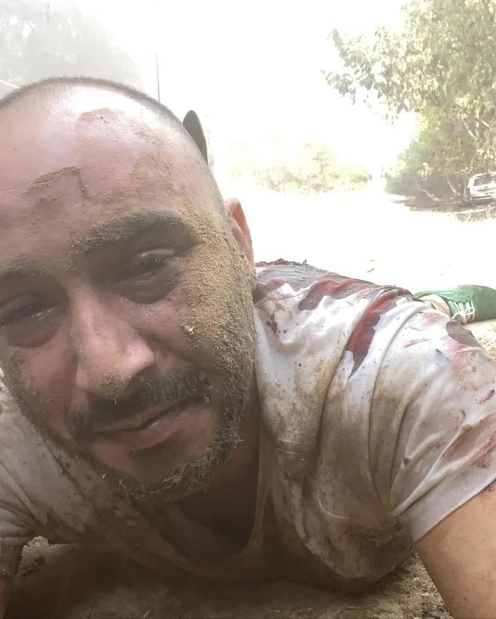 Roei Shalev於音樂節身中兩槍,靠著裝死7小時保住一命。(X)