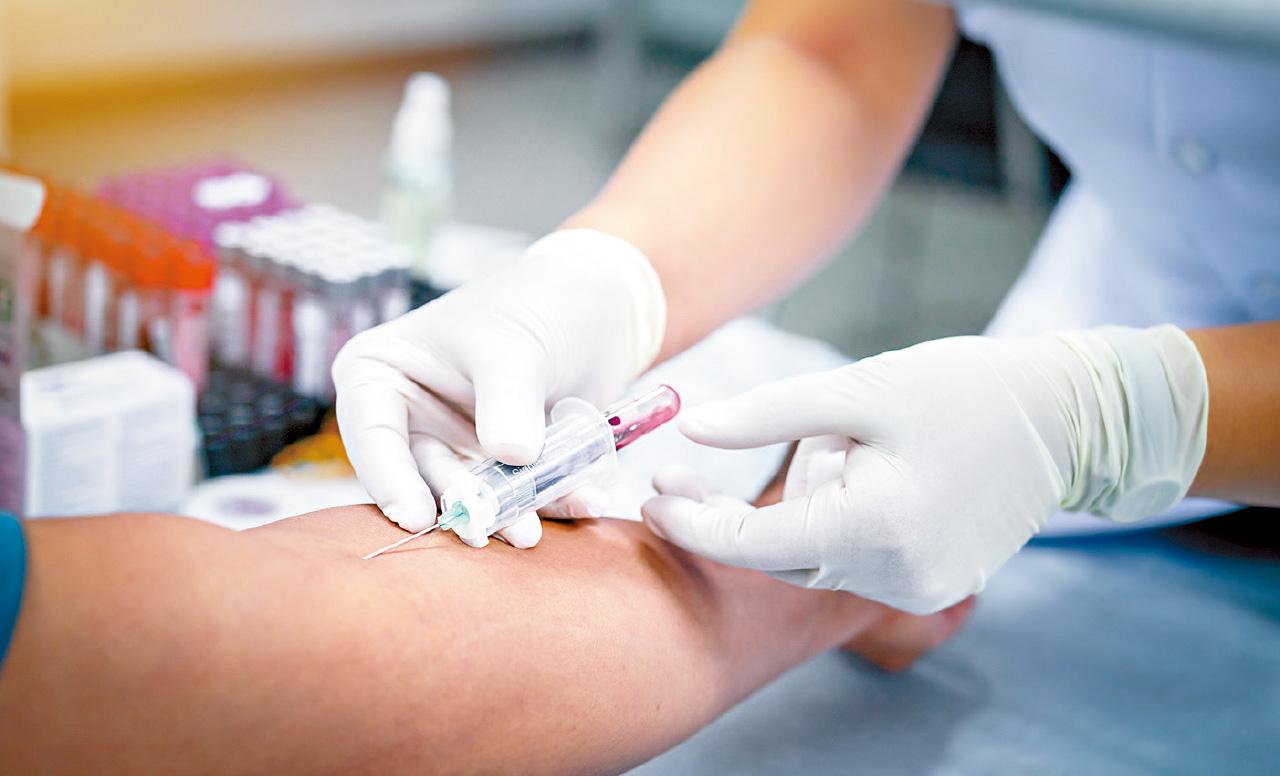 血液檢測 揪認知障礙隱性高危者