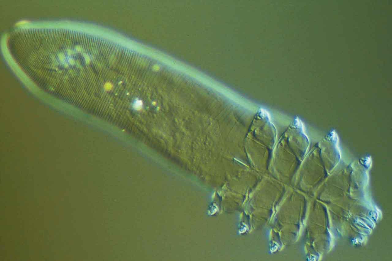 玫瑰痤瘡患者面部或有過多蠕形蟎蟲。