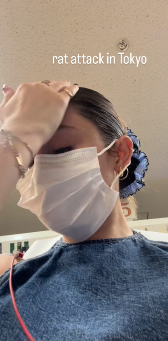 東京新宿街頭遭老鼠咬 女遊客腳背大量流血(有片)|日本旅遊