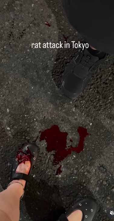 東京新宿街頭遭老鼠咬 女遊客腳背大量流血(有片)|日本旅遊