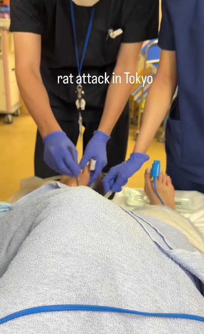 東京新宿街頭遭老鼠咬 女遊客腳背大量流血(有片)|日本旅遊