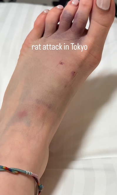 東京新宿街頭遭老鼠咬 女遊客腳背大量流血(有片)|日本旅遊