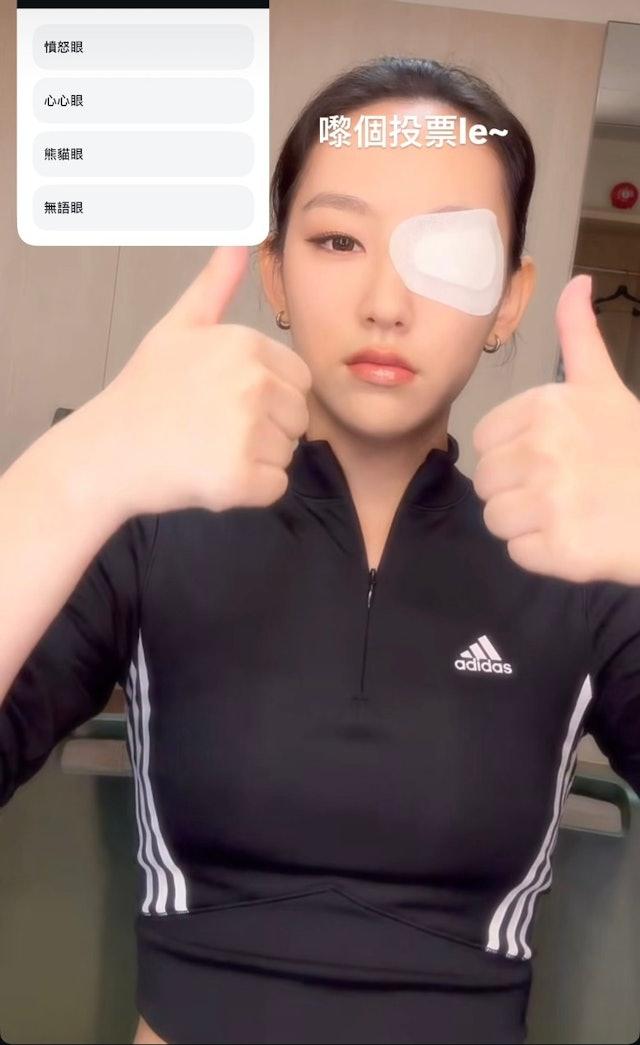 炎明熹昨日在IG發布眼睛受傷貼上紗布的照片,俏皮地邀請fans投票。