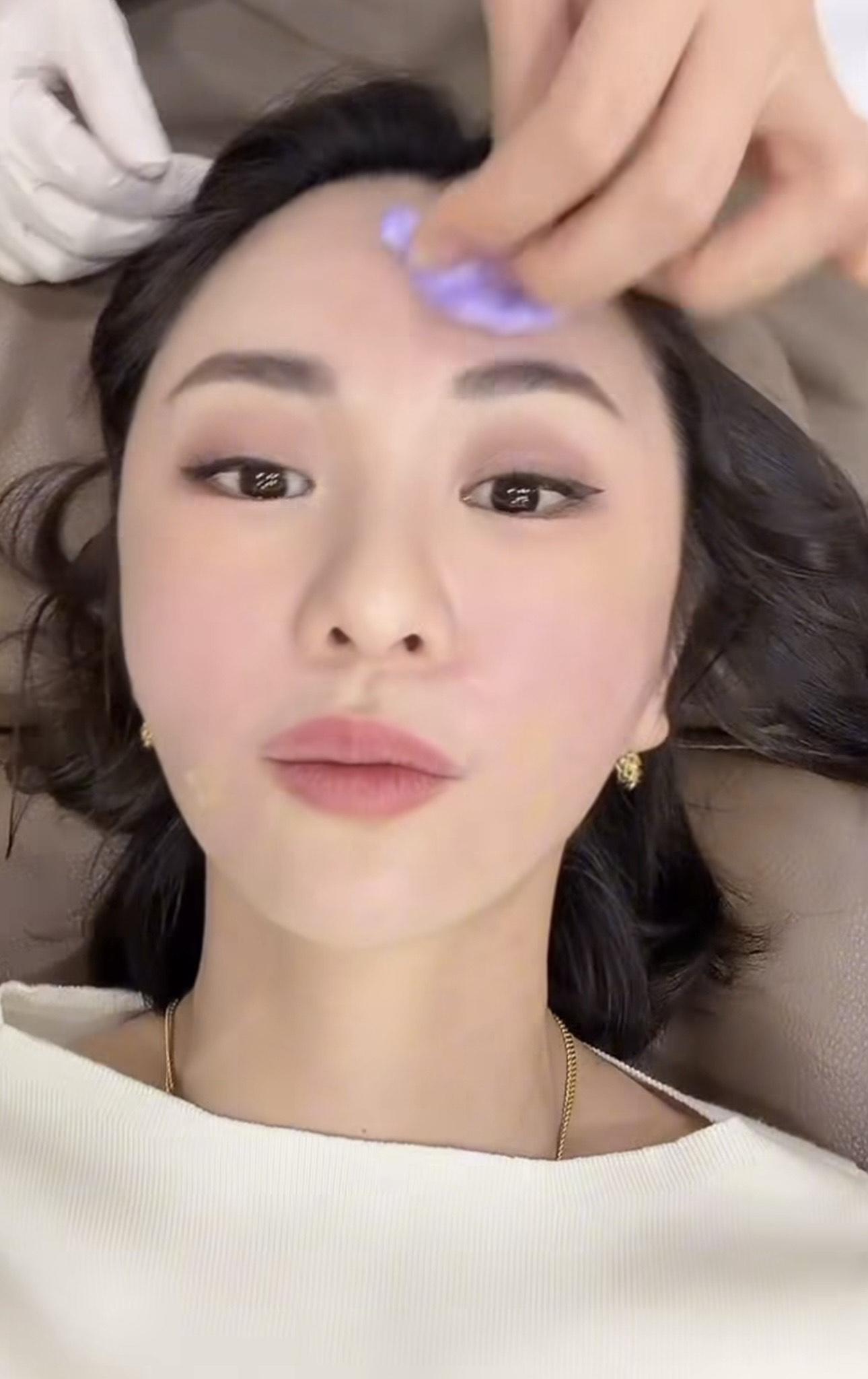 裕美直言打鼻梁最痛。